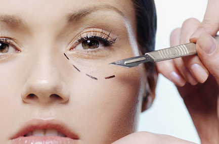 Schéma Blépharoplastie Inférieure