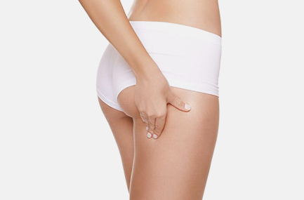 Schéma Lifting Cuisses 2