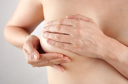 Schéma Lifting Seins 1