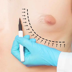 chirurgie esthétique homme tunisie