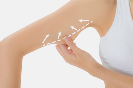 Schéma Lifting Bras 1