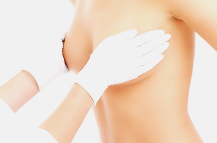 Schéma Réduction Mammaire 2