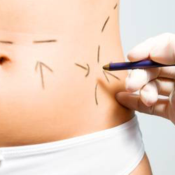 devis chirurgie obésité tunisie