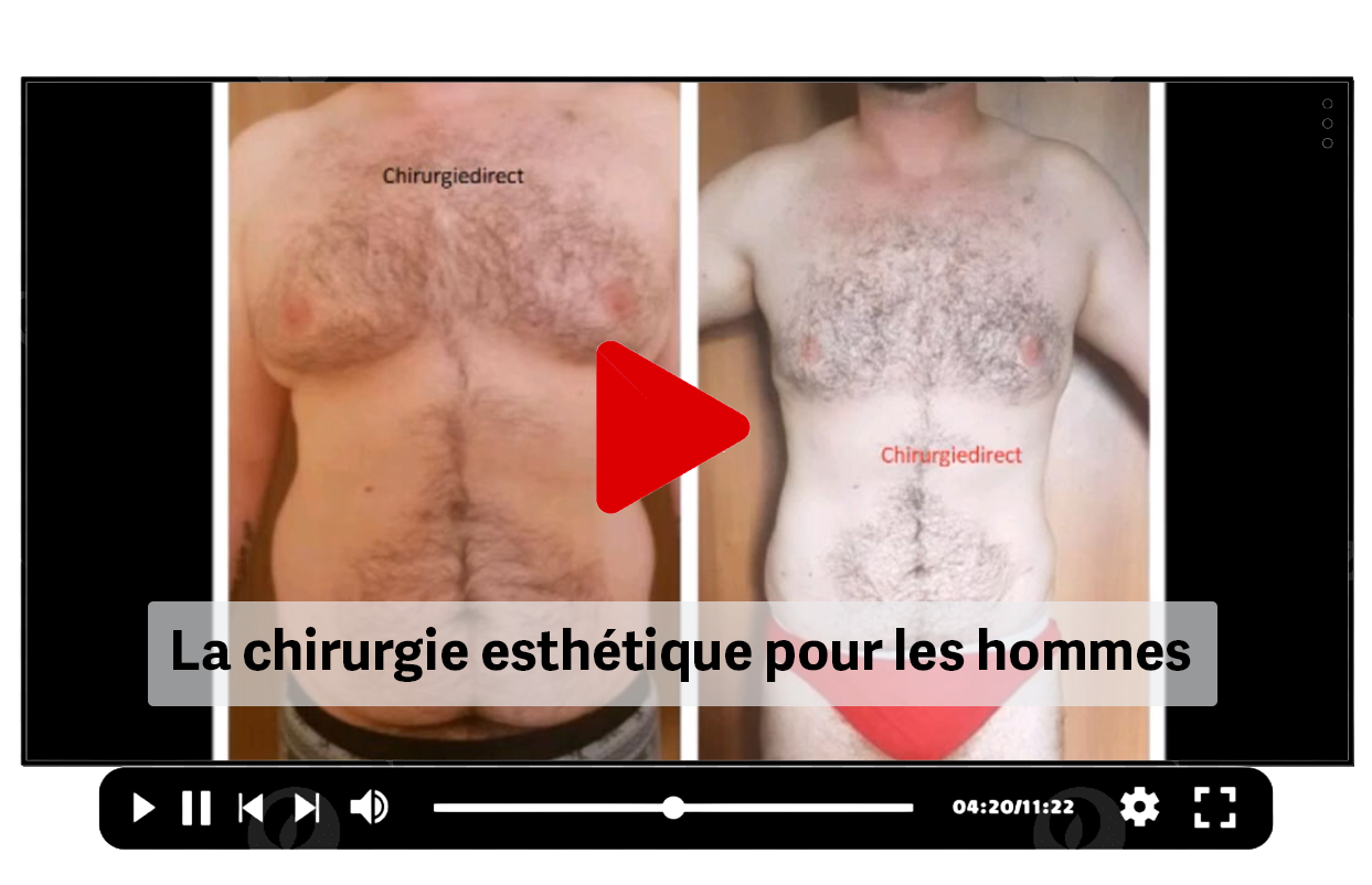 devis chirurgie esth&eacute;tique pour homme en tunisie